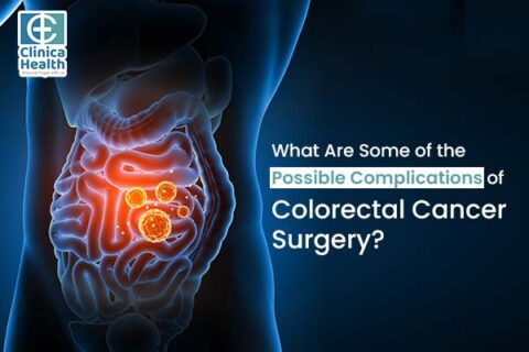 Possible Complications Of Colorectal Cancer Surgery