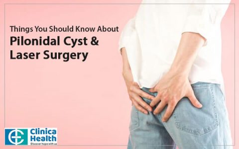 Things You Should Know About Pilonidal Cyst Laser Surgery