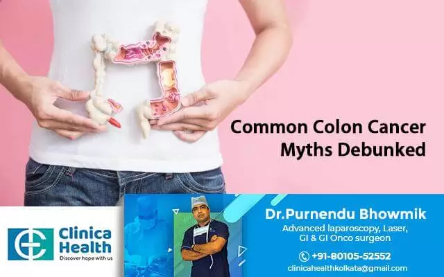 Common Colon Cancer Myths Debunked