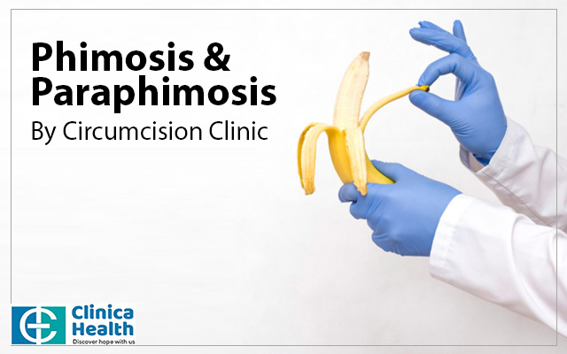 The Management of Phimosis Seen after Circumcision with
