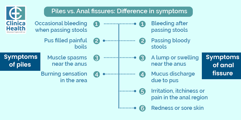 Piles vs. Anal fissures Difference in symptoms 