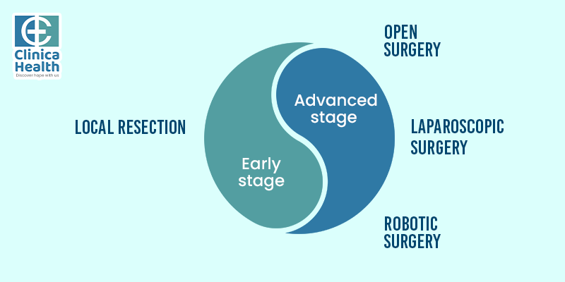 What are the types of surgery to treat rectal cancer?