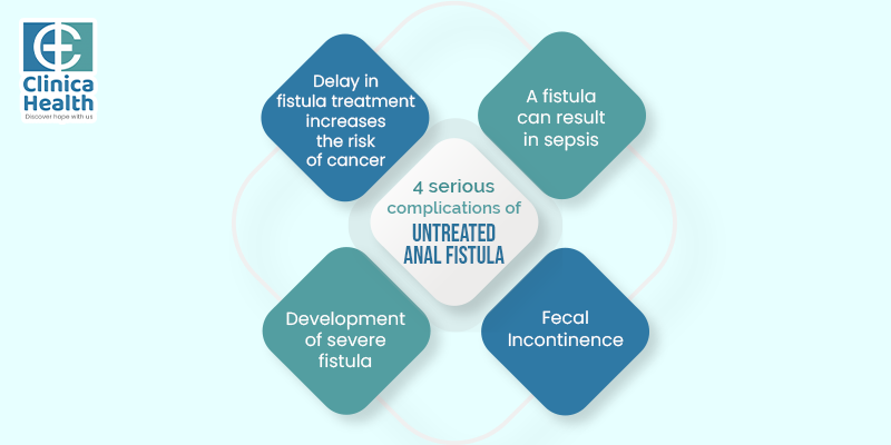 4 serious complications of untreated anal fistula 