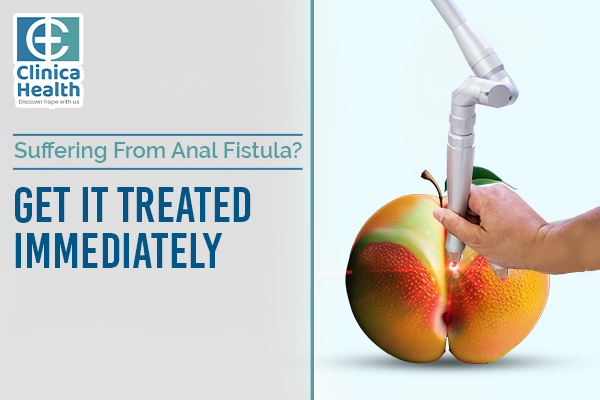 Suffering From Anal Fistula Get It Treated Immediately