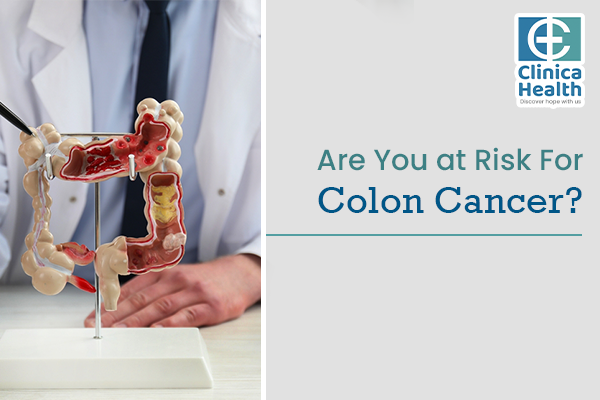 Are you at risk for colon cancer?