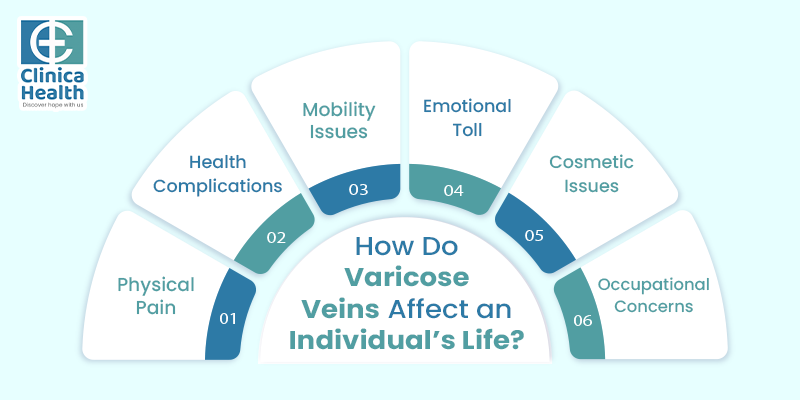 How do varicose veins affect an individual’s life?