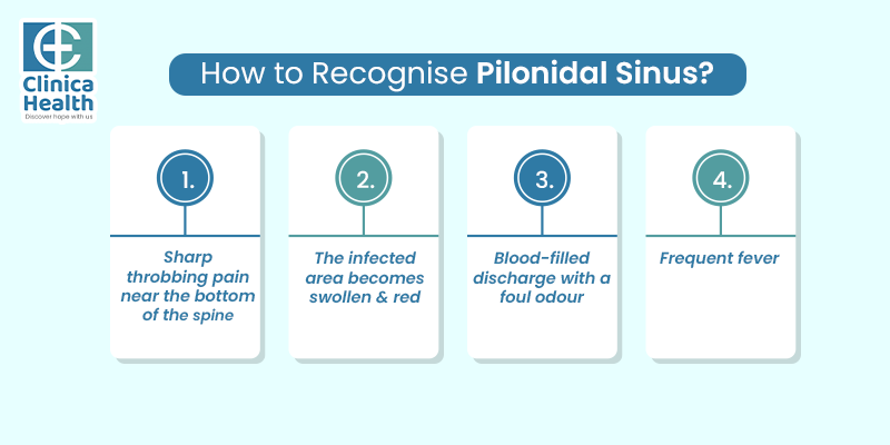 How to recognise pilonidal sinus