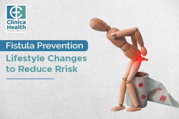 Fistula prevention Lifestyle changes to reduce risk