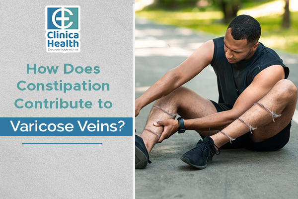 How does constipation contribute to varicose veins