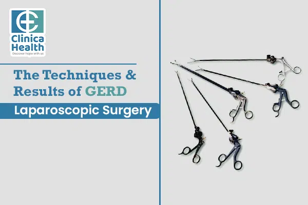 The techniques and results of GERD laparoscopic surgery