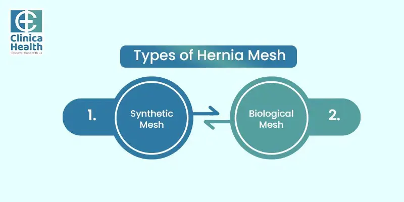 Types of hernia mesh: Synthetic mesh and Biological mesh